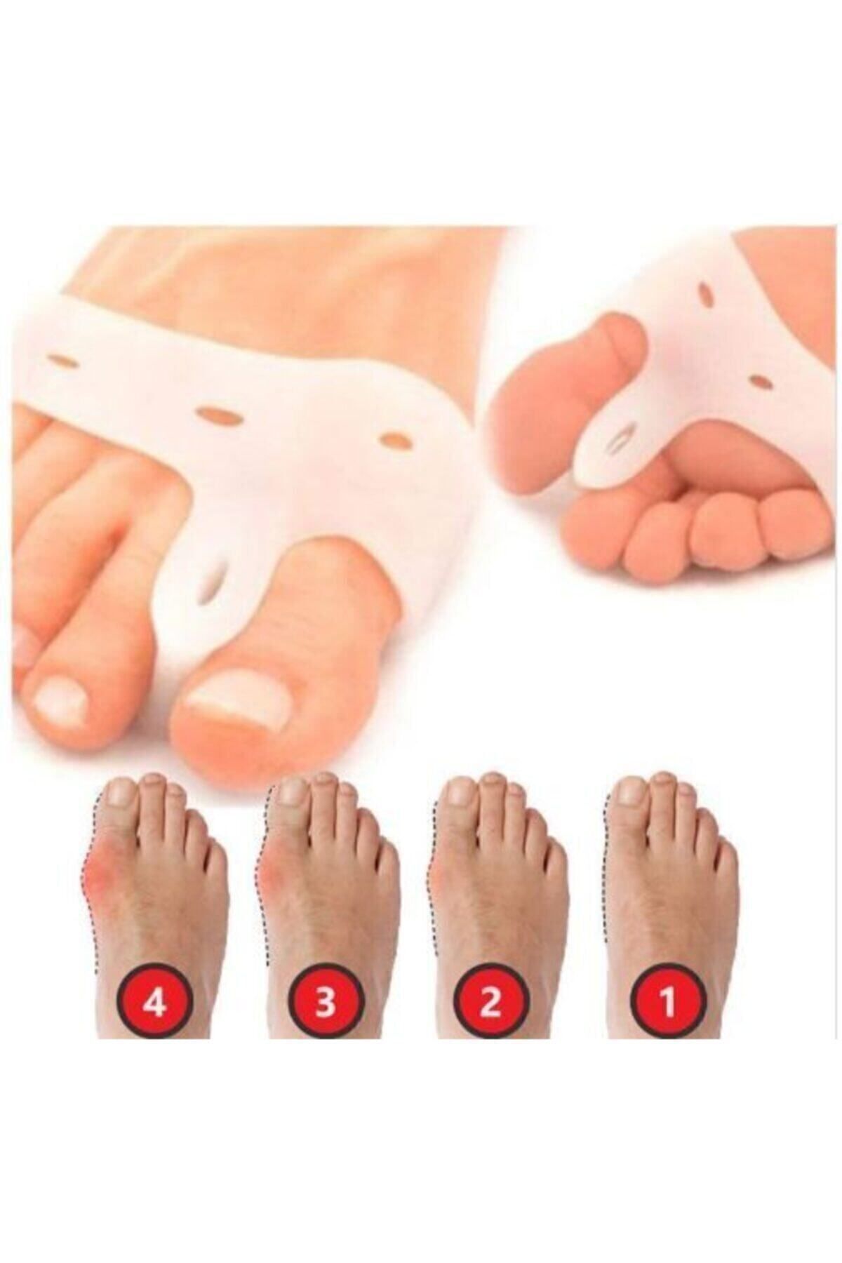 Silikon Makaralı Ayak Baş Parmak Gömleği Kemik Bunyon Düzeltici Makaralı Parmak Ayırıcı Halluks 2 Tek Ebat